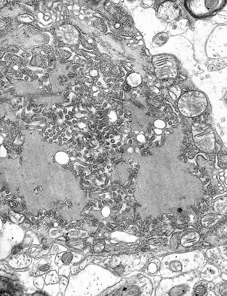 Image credit: CDC/Dr. Fred Murphy