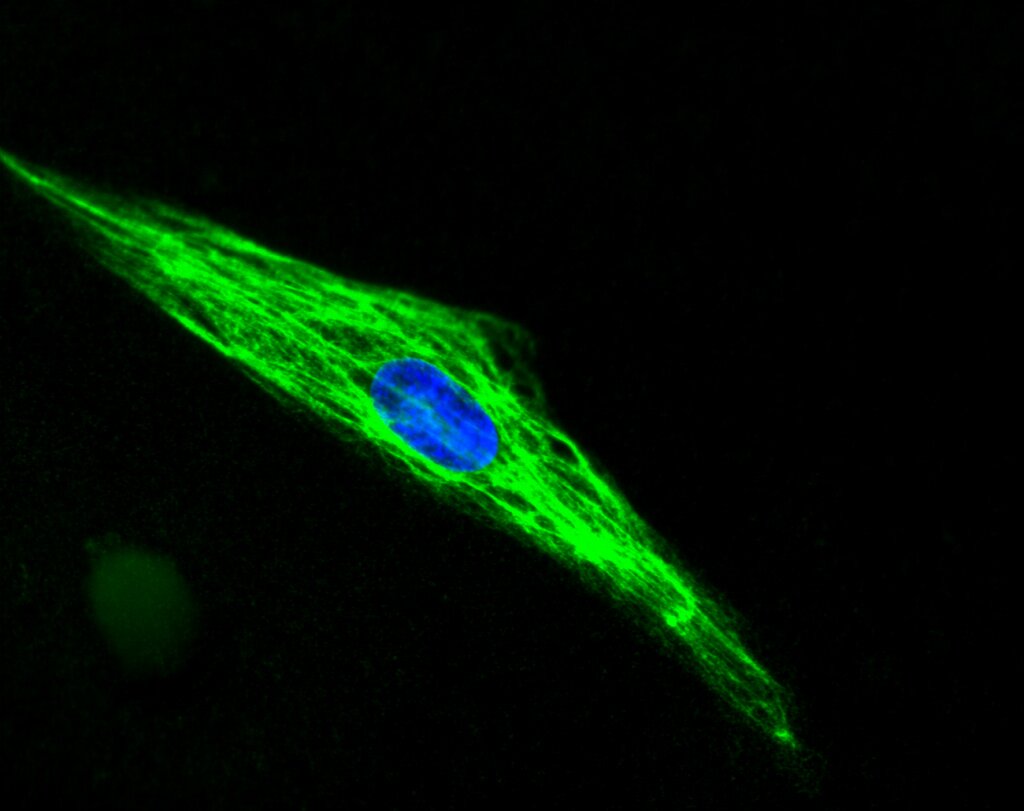 Image credit: Inserm/UPMC/CNRS/AIM