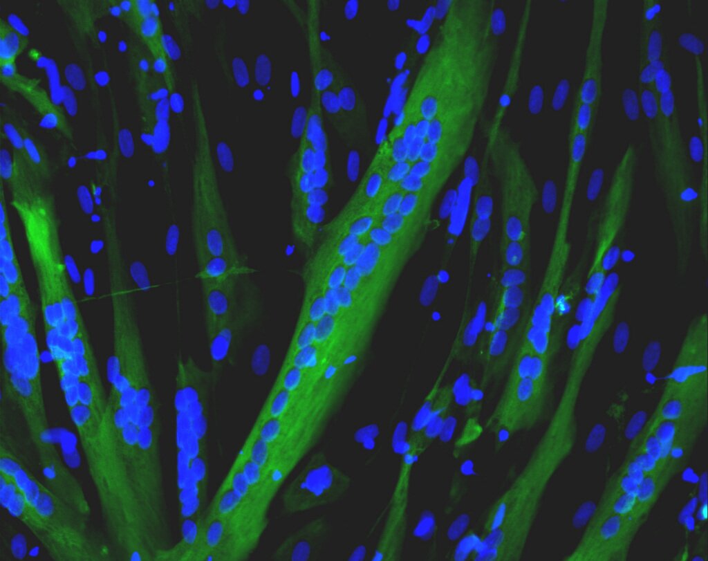 Image credit: Inserm/UPMC/CNRS/AIM