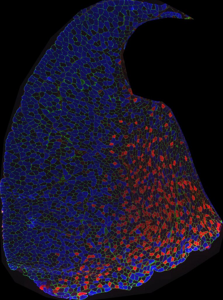 Image credit: Inserm/UPMC/CNRS/AIM