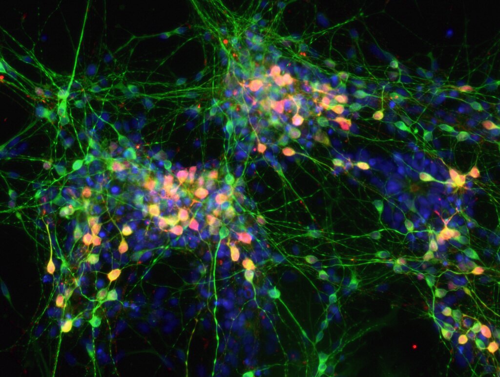 Image credit: Inserm / A. Perrier 