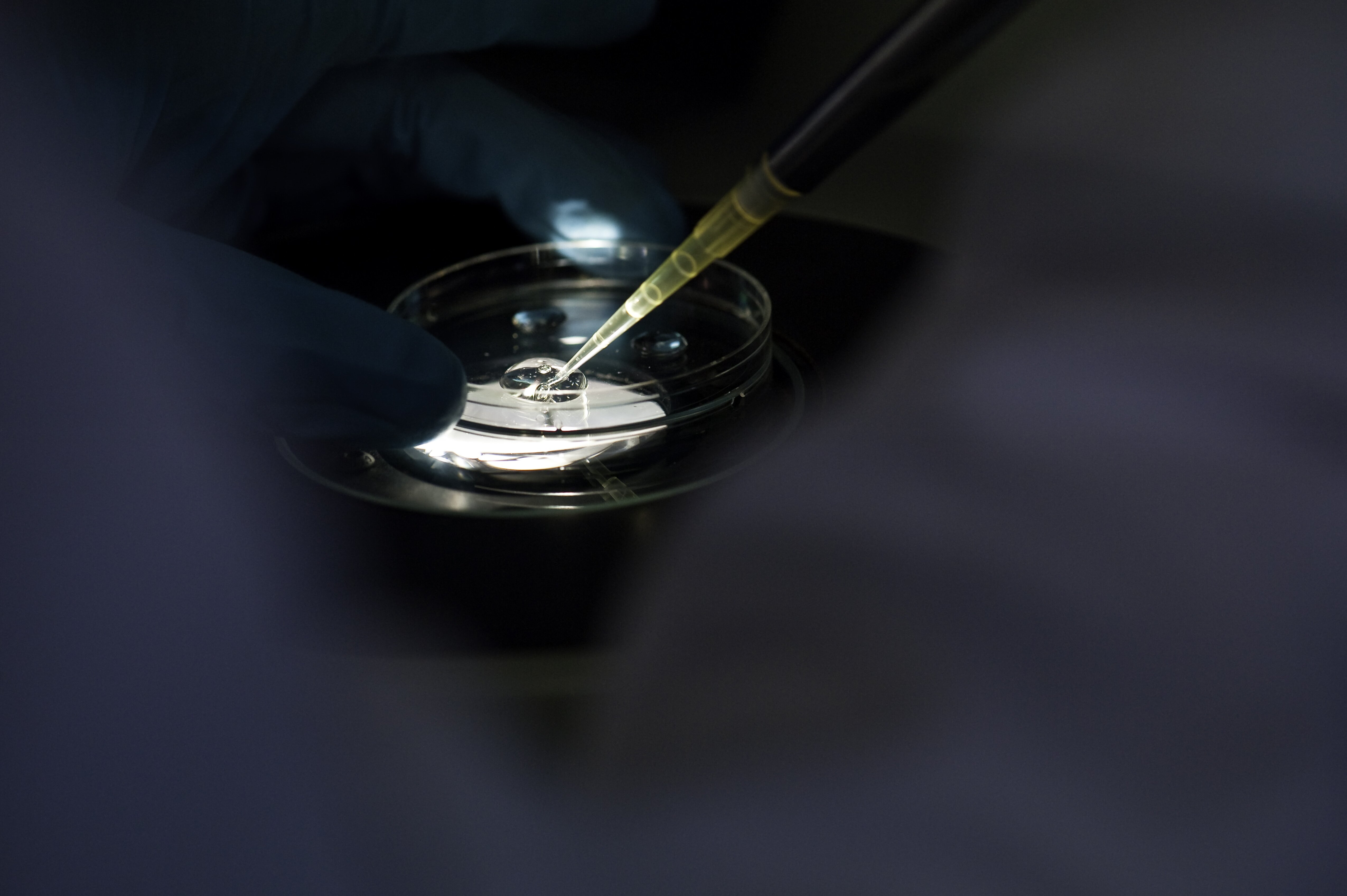 Image credit: Inserm / P. Latron