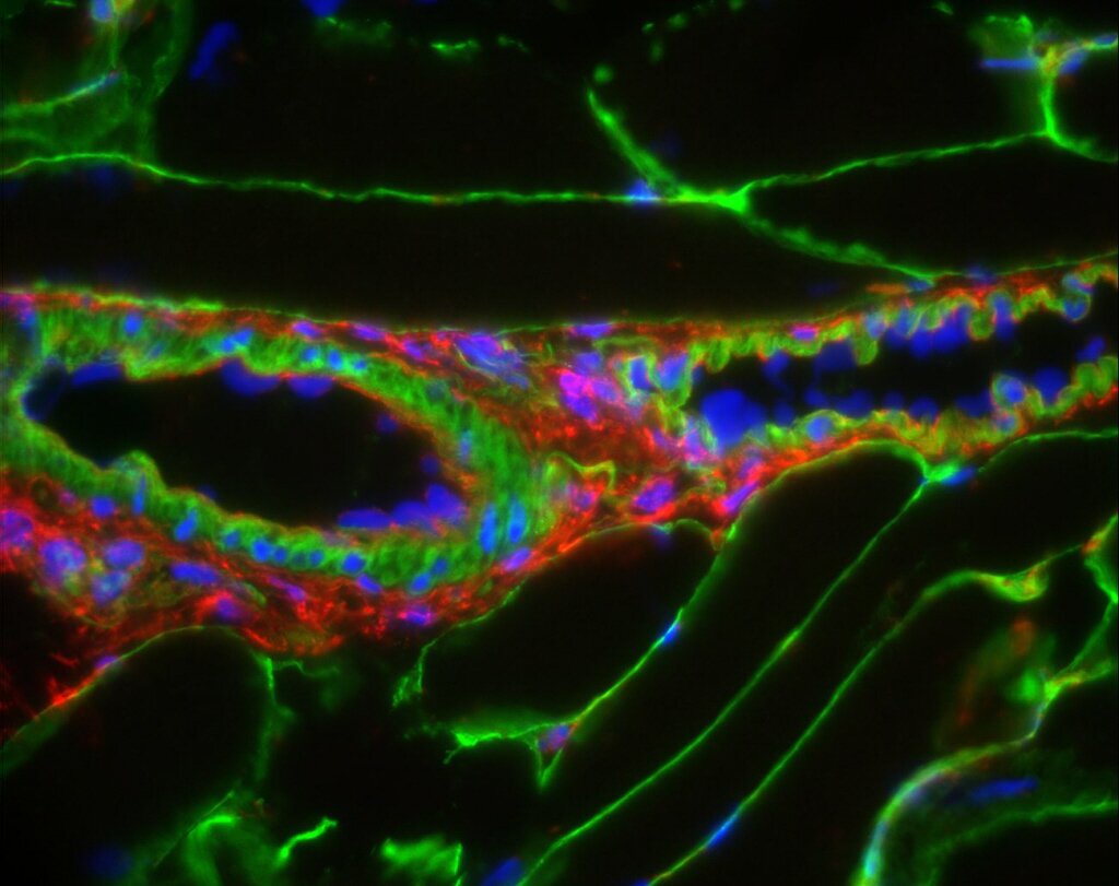 Image credit: Inserm/UPMC/CNRS/AIM